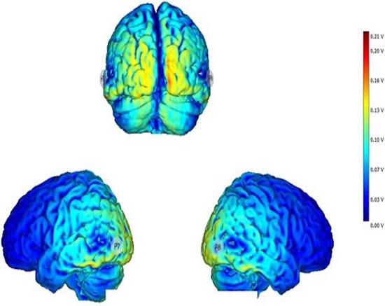 Brain Stimulation and Cognition